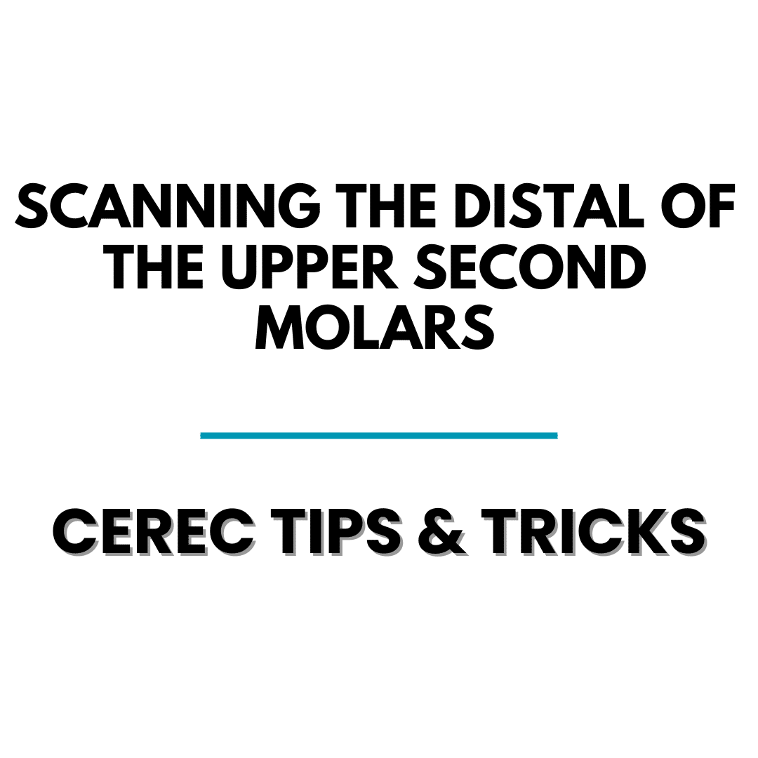 Tips and Tricks - Scanning the Distal of the Upper Second Molars