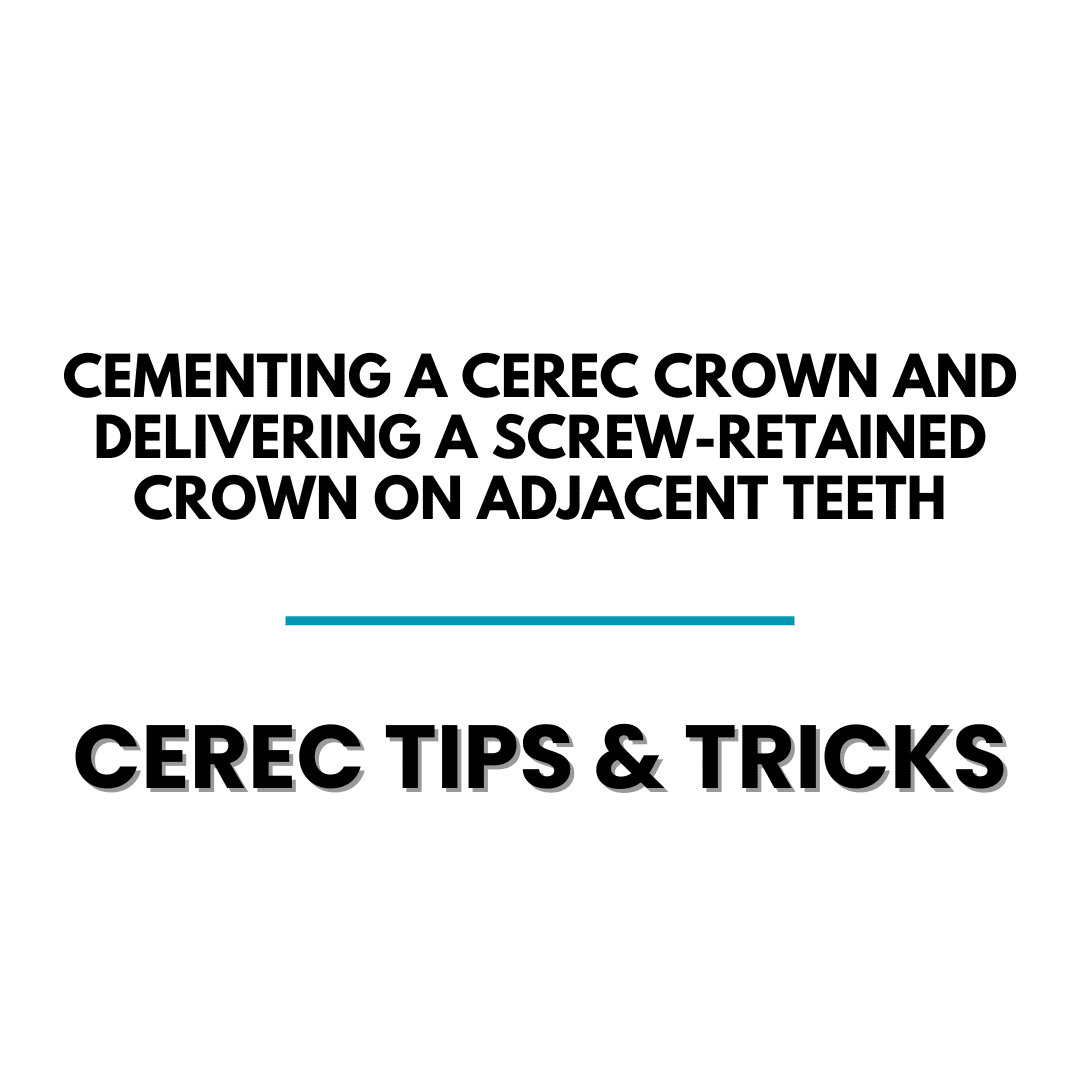 Sequence of Events for Cerec Crown and Implant Crown Cases - Cerec Docs